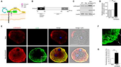 EhVps23, an ESCRT-I Member, Is a Key Factor in Secretion, Motility, Phagocytosis and Tissue Invasion by Entamoeba histolytica